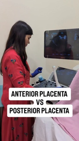 Why placenta position matters in pregnancy