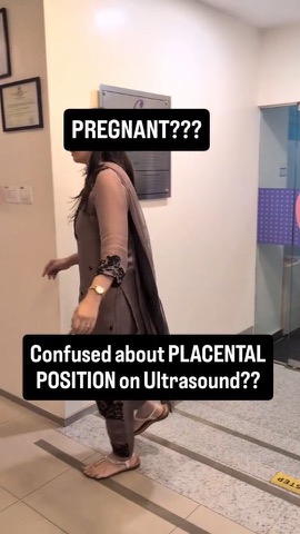 Placental position on your scan — what it actually means